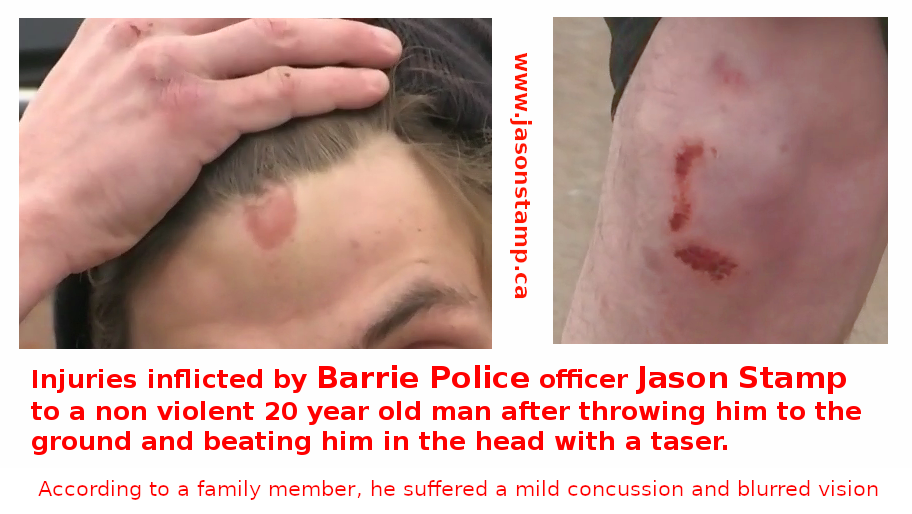Barrie Police Jason Stamp's victim injuries